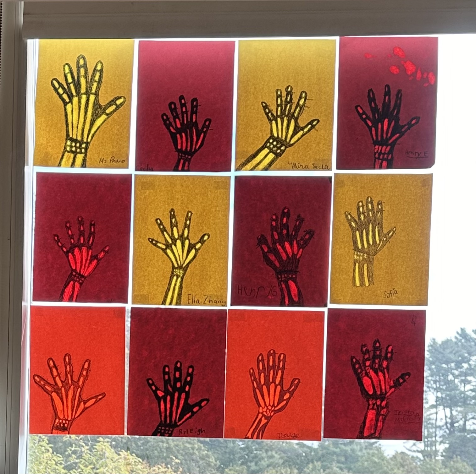 Why do skeletons have so many bones?