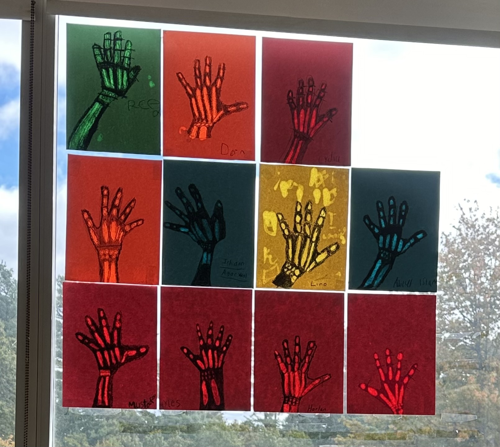 Why do skeletons have so many bones? 2